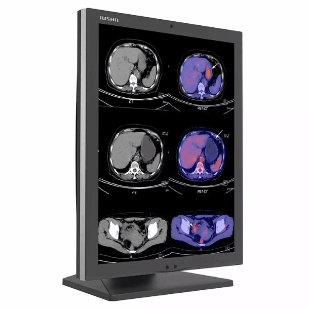 Monitor de Diagnóstico C270G com resolução WQHD