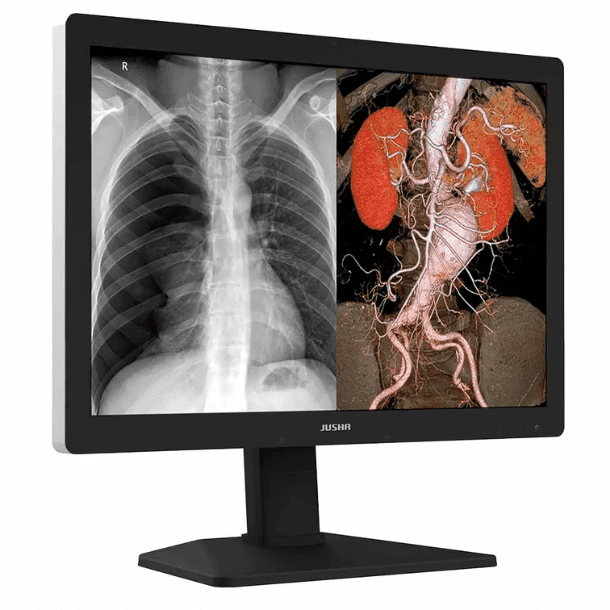 Monitor de Diagnóstico C630G em uso clínico