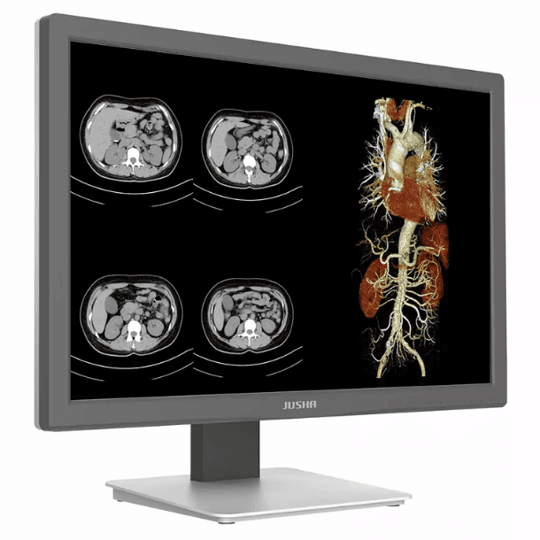 Monitor de Diagnóstico CR240G para exames clínicos