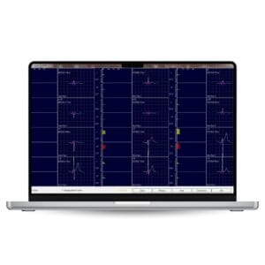 CardioScan Stress Test