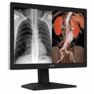 Monitor de Diagnóstico C630G